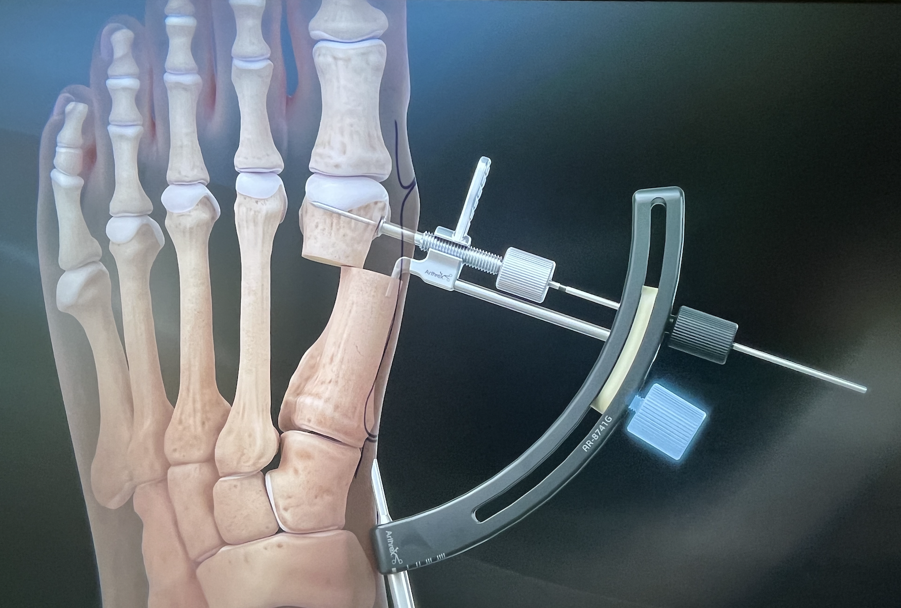 Imagen de Grigorii Eremian ofreciendo la mano